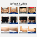 Shape Tactics 360° RF Ultrasonic Cavitation Vacuum for Body Slimming and Sculpting