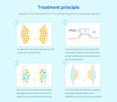 Dispositivo de adelgazamiento por vacío con congelación de grasa y criolipólisis de doble mango Shape Tactics