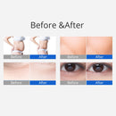 Shape Tactics 3-in-1 40K Lipo Ultrasonic Cavitation Slimming Machine