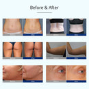 Máquina de cavitación por vacío en frío y criolipólisis 4 en 1 Shape Tactics