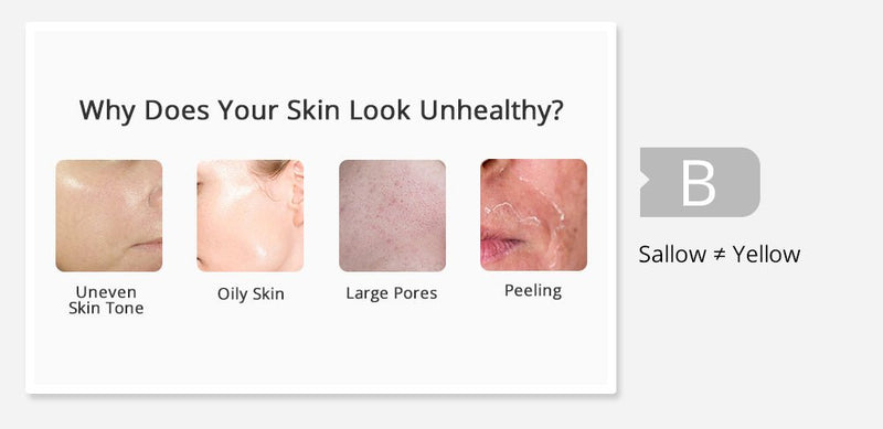 Shape Tactics 5-in-1 Diamond Water Peel Microdermabrasion Machine