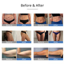 Shape Tactics 5-in-1 RF Ultrasonic Cavitation Machine with 40K Ultrasound