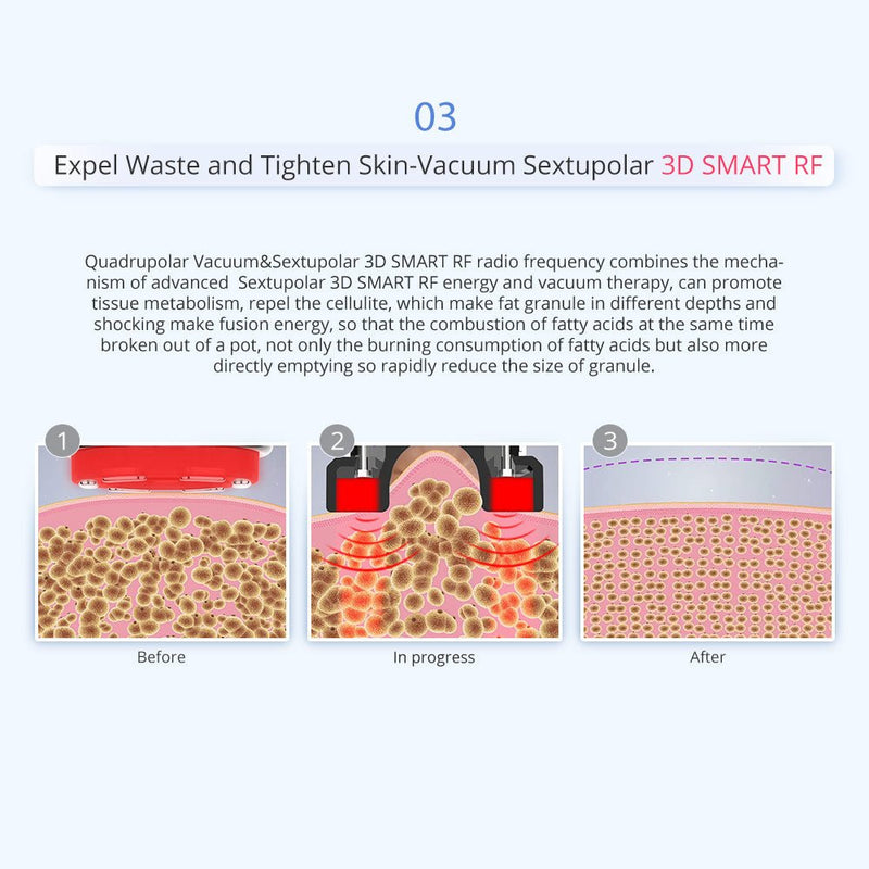 Shape Tactics 5-in-1 Unoisetion Cavitation 2.0 Vacuum RF Machine