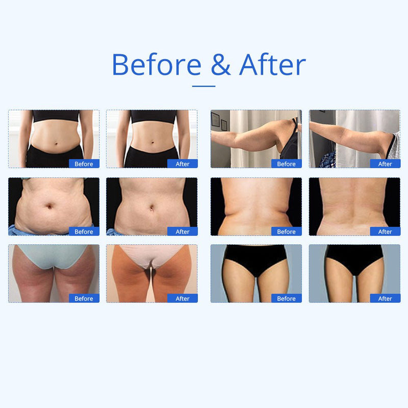 Shape Tactics 5-in-1 Unoisetion Cavitation 2.0 Vacuum RF Machine