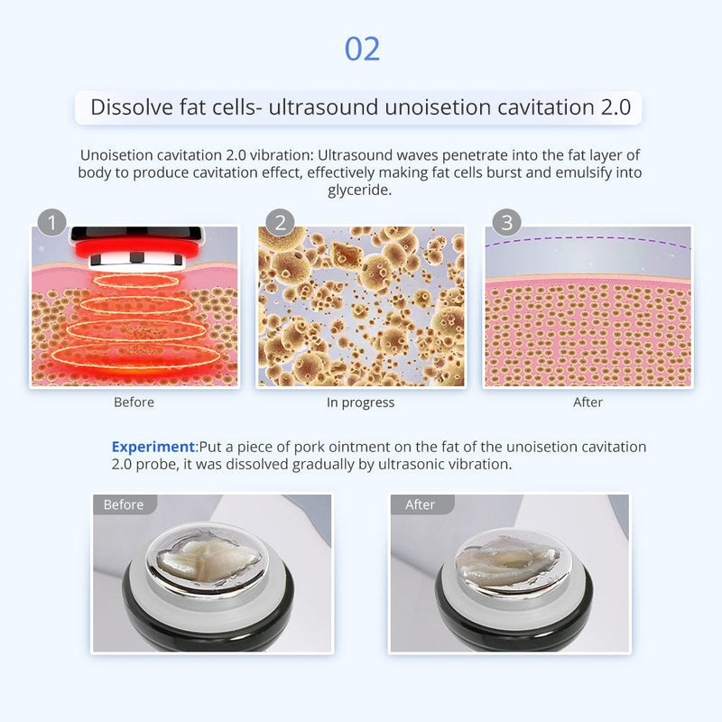 Shape Tactics 5-in-1 Unoisetion Cavitation 2.0 Vacuum RF Machine