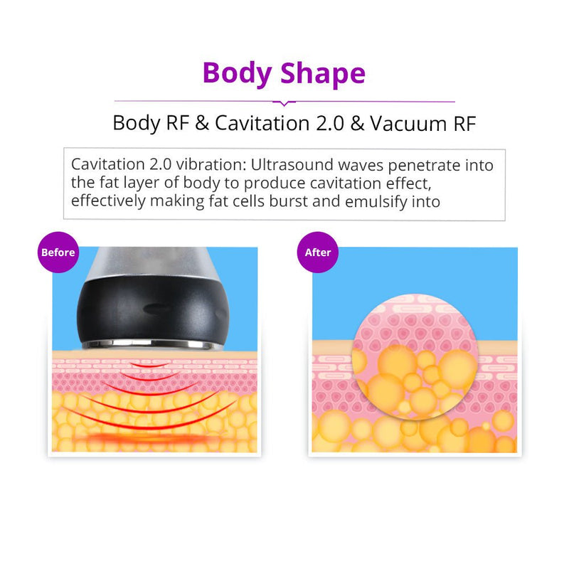 Shape Tactics 5-in-1 Vacuum Cavitation Multipolar Radio Frequency