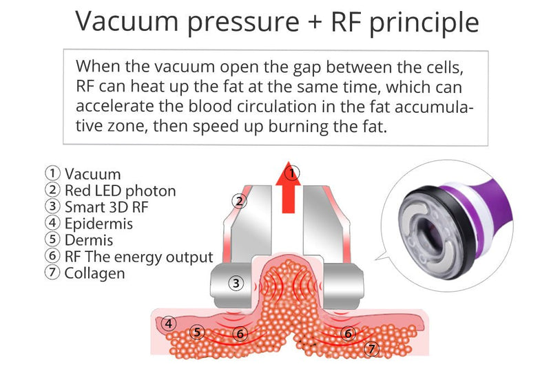 Shape Tactics 5-in-1 40K Cavitation RF Therapy Machine