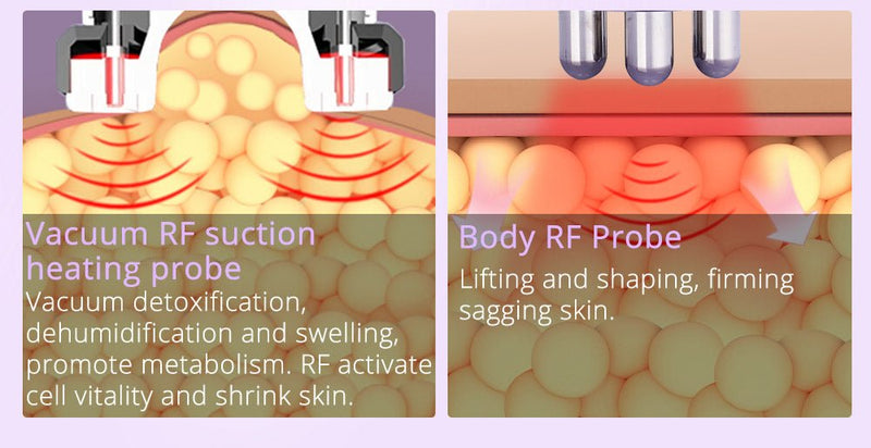 Shape Tactics 6-in-1 2.5 Ultrasonic Lipo Cavitation RF Body Slimming Device