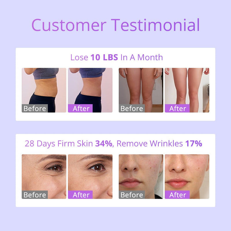 Shape Tactics - 6-in-1 30K Cavitation Vacuum Lipo RF