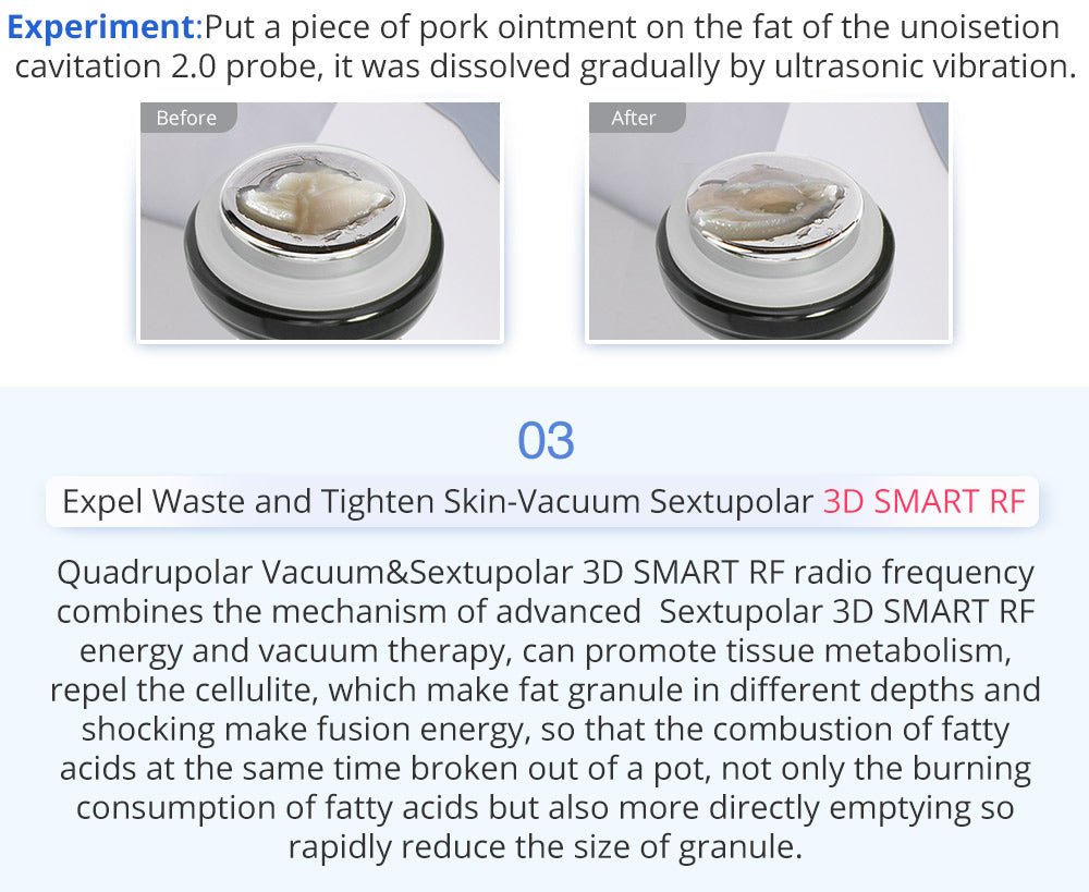 Shape Tactics 6-in-1 Advanced Unoisetion Cavitation 2.0 Vacuum RF Body