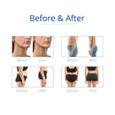 Shape Tactics - 6-in-1 Cavitation Lipo Laser RF Cryolipolysis Machine