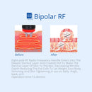 Shape Tactics - 6-in-1 Cavitation Lipo Laser RF Cryolipolysis Machine