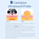 Shape Tactics - 6-in-1 Cavitation Lipo Laser RF Cryolipolysis Machine