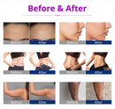 Shape Tactics 6-in-1 Cavitation LED Laser Lipo & RF Body Sculpting System