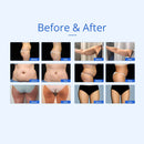 Máquina de cavitación ultrasónica RF de 40K con calor y frío 7 en 1 de Shape Tactics 