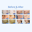 Máquina de cavitación ultrasónica RF de 40K con calor y frío 7 en 1 de Shape Tactics 