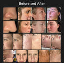 Shape Tactics 8-in-1 Hot & Cold Fusion Plasma Facial Beauty System