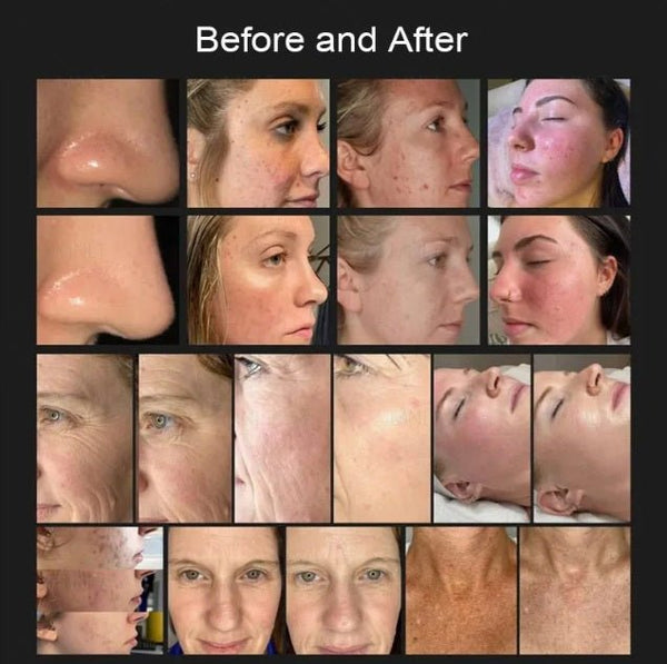 Shape Tactics 8-in-1 Hot & Cold Fusion Plasma Facial Beauty System