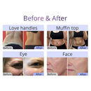 Shape Tactics 8-in-1 RF Cavitation Sculpt System
