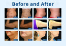 Shape Tactics - Advanced 3-Handle Cryolipolysis Fat Sculpting