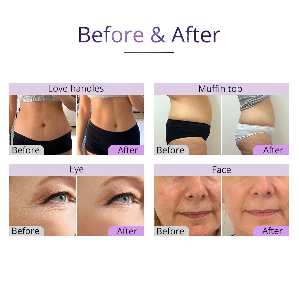 Shape Tactics Advanced 5-in-1 2.5 40K Cavitation Vacuum RF Technology