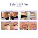 Tecnología avanzada de cavitación por vacío RF Shape Tactics 5 en 1 2.5 40K