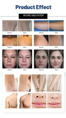 Shape Tactics Advanced Laser System with DPL OPT IPL Technology