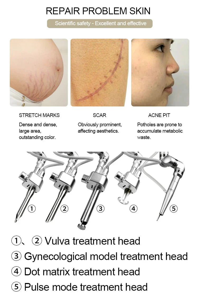 Shape Tactics CO2 Dot Laser Microvascular Reconstruction Therapy Device