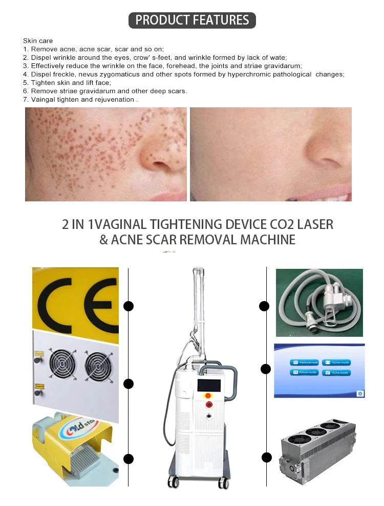 Shape Tactics CO2 Dot Laser Microvascular Reconstruction Therapy Device