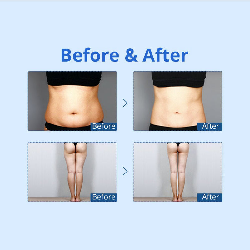 Shape Tactics - Cryolipoysis Cold Vacuum Fat Freeze Shaping Machine