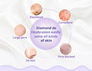 Shape Tactics Diamond Microdermabrasion Machine for Blackhead Removal
