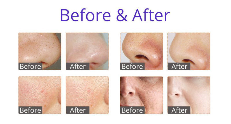 Shape Tactics - HydroGlow Pro: 6-in-1 Facial Beauty System