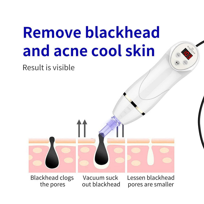 Shape Tactics Microdermabrasion Vacuum Spray for Deep Facial Cleansing
