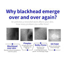 Spray de vacío para microdermoabrasión Shape Tactics para una limpieza facial profunda