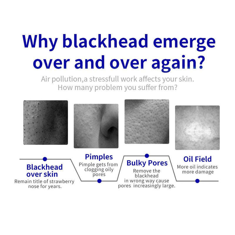 Shape Tactics Microdermabrasion Vacuum Spray for Deep Facial Cleansing