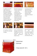 Shape Tactics Multi-Directional Fat Reduction Beauty Machine with EMS RF