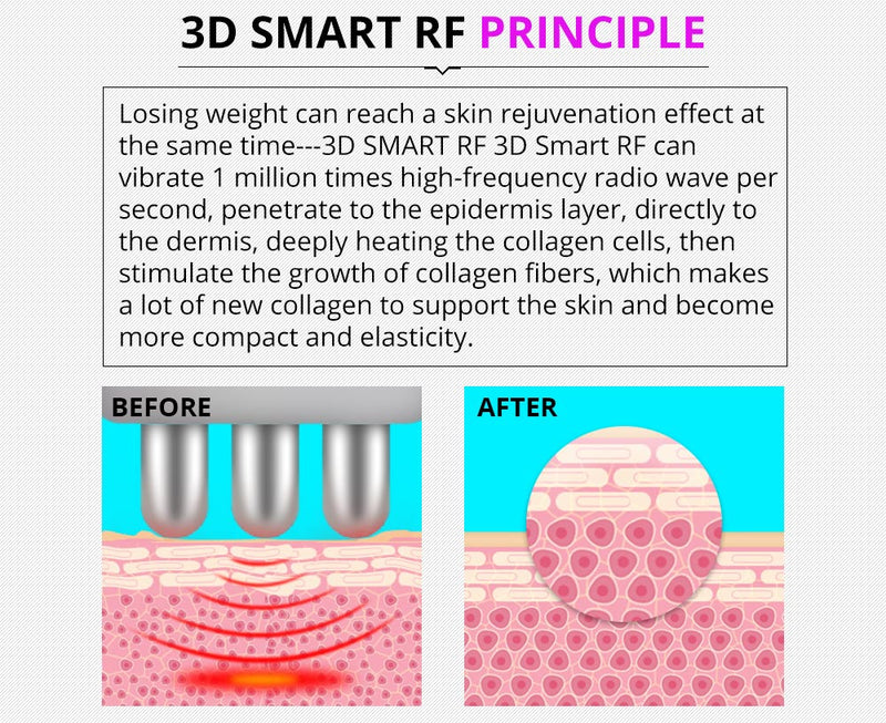 Shape Tactics Multifunctional 5-in-1 Ultrasonic Cavitation Vacuum RF Beauty Device