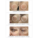 Shape Tactics PDT 408 LED Photon Photodynamic Beauty Device