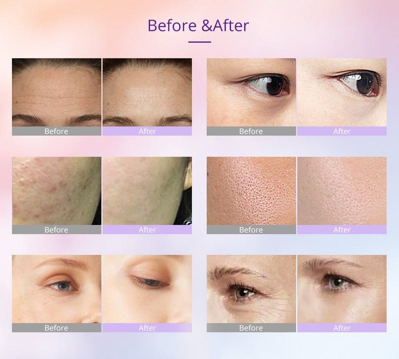 Shape Tactics - Photon LED Facial Care Micro Current Beauty Device