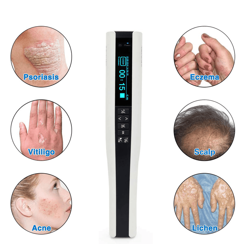 Shape Tactics Portable 311nm UVB Phototherapy Light