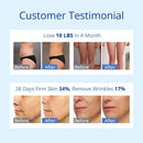 Sistema de cavitación RF y láser lipo de 160 MW Shape Tactics S-Shape 30K