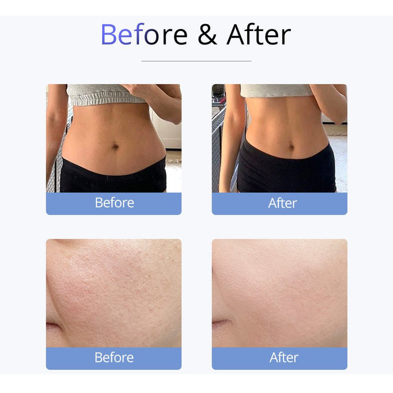Shape Tactics - S-Shape Ultrasonic 30K Cavitation EMS Vacuum