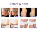 Shape Tactics - UltraShape 2.5 Cavitation Device