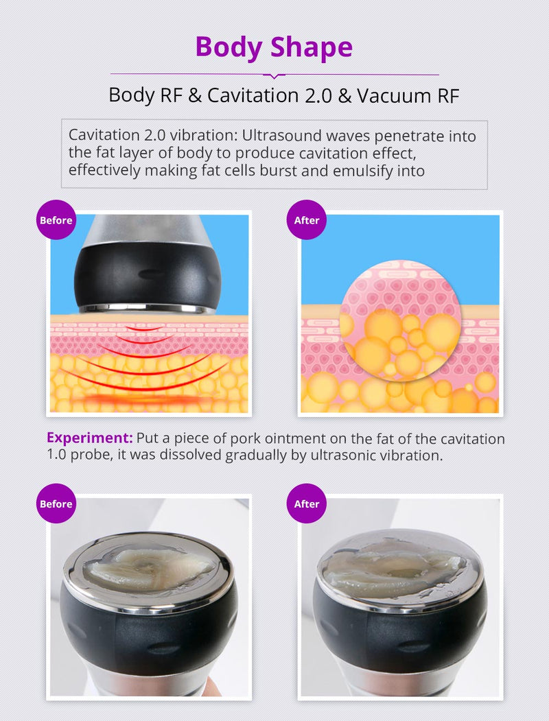Shape Tactics - Unoisetion 40k Cavitation Ultrasound RF Multipolar Vacuum Photon