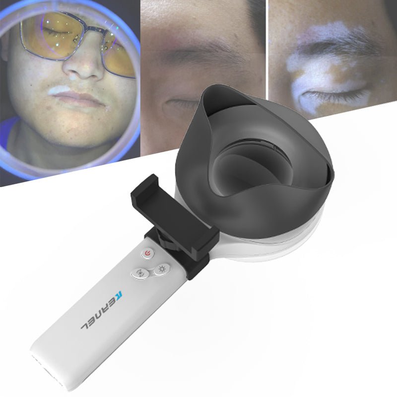 Shape Tactics UV Magnifying Lamp for Skin Analysis