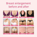 Shape Tactics - Mejora del masaje con succión al vacío BBL 