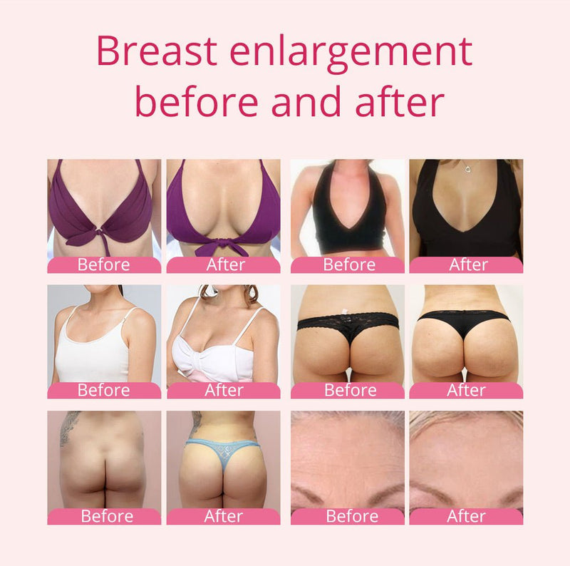 Shape Tactics - BBL Vacuum Suction Massage Enhancement